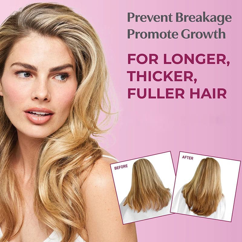 Bosley MD MendXtend Strengthening System Kit, 3 Pieces - Image 3