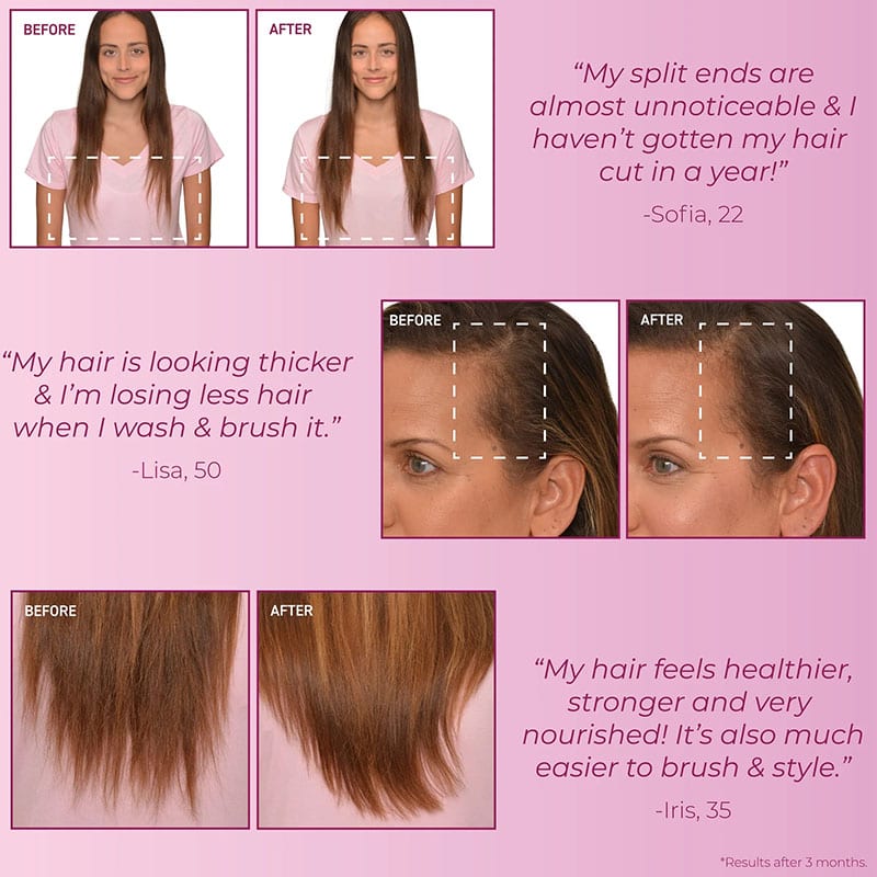 Bosley MD MendXtend Strengthening System Kit, 3 Pieces - Image 7